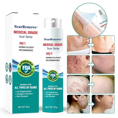 Advanced Scar Spray