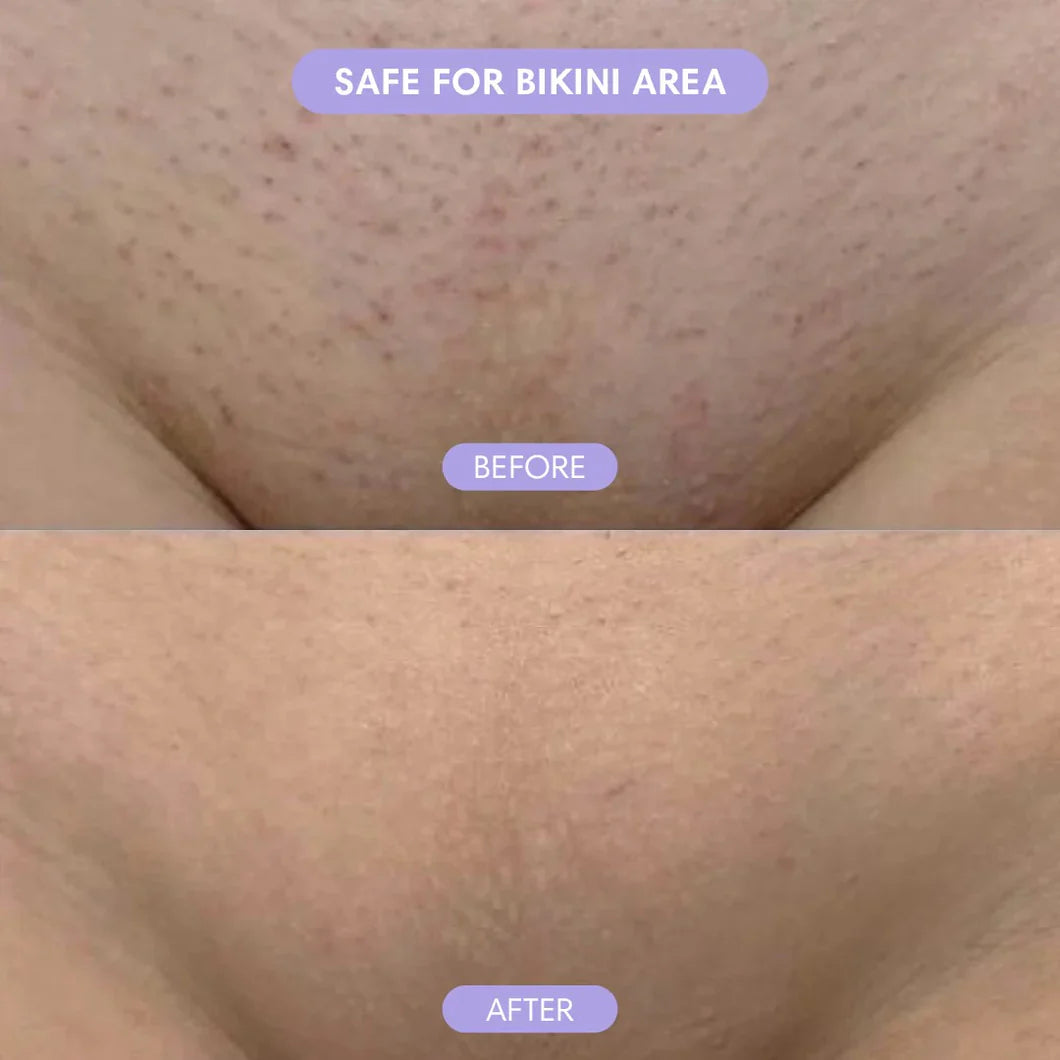 Wholly Bare™  Hair Removal Mousse (Gentle Body Hair Removal Cream)