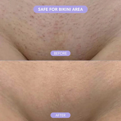 Wholly Bare™  Hair Removal Mousse (Gentle Body Hair Removal Cream)